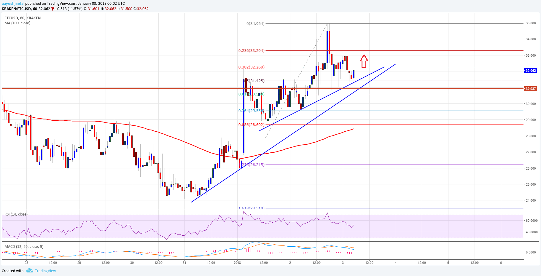 Etrade B!   itcoin Malaysia Bitcoin Ethereum Chart Cemza Tekstil - 